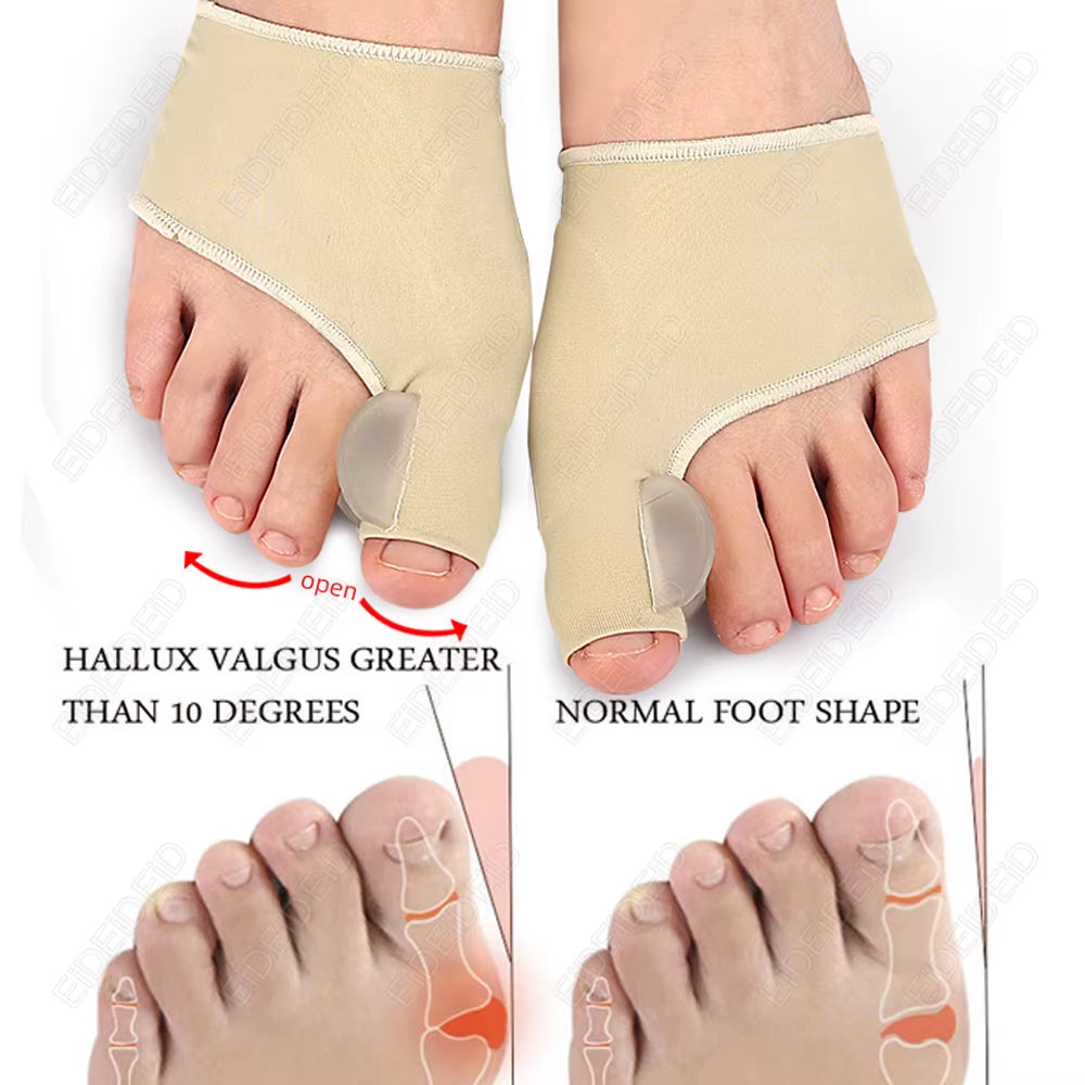 Hallux Valgus Bunion Corrector Silicone Gel Toe Separator Big Toe Straightener Orthopedic Sleeve Sock Pain Relief