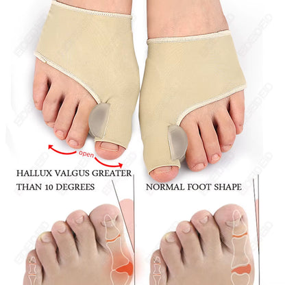 Hallux Valgus Bunion Corrector Silicone Gel Toe Separator Big Toe Straightener Orthopedic Sleeve Sock Pain Relief